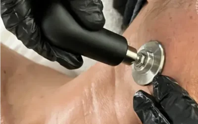Indiba en Valencia: Tecnología estética para el empoderamiento y el autocuidado